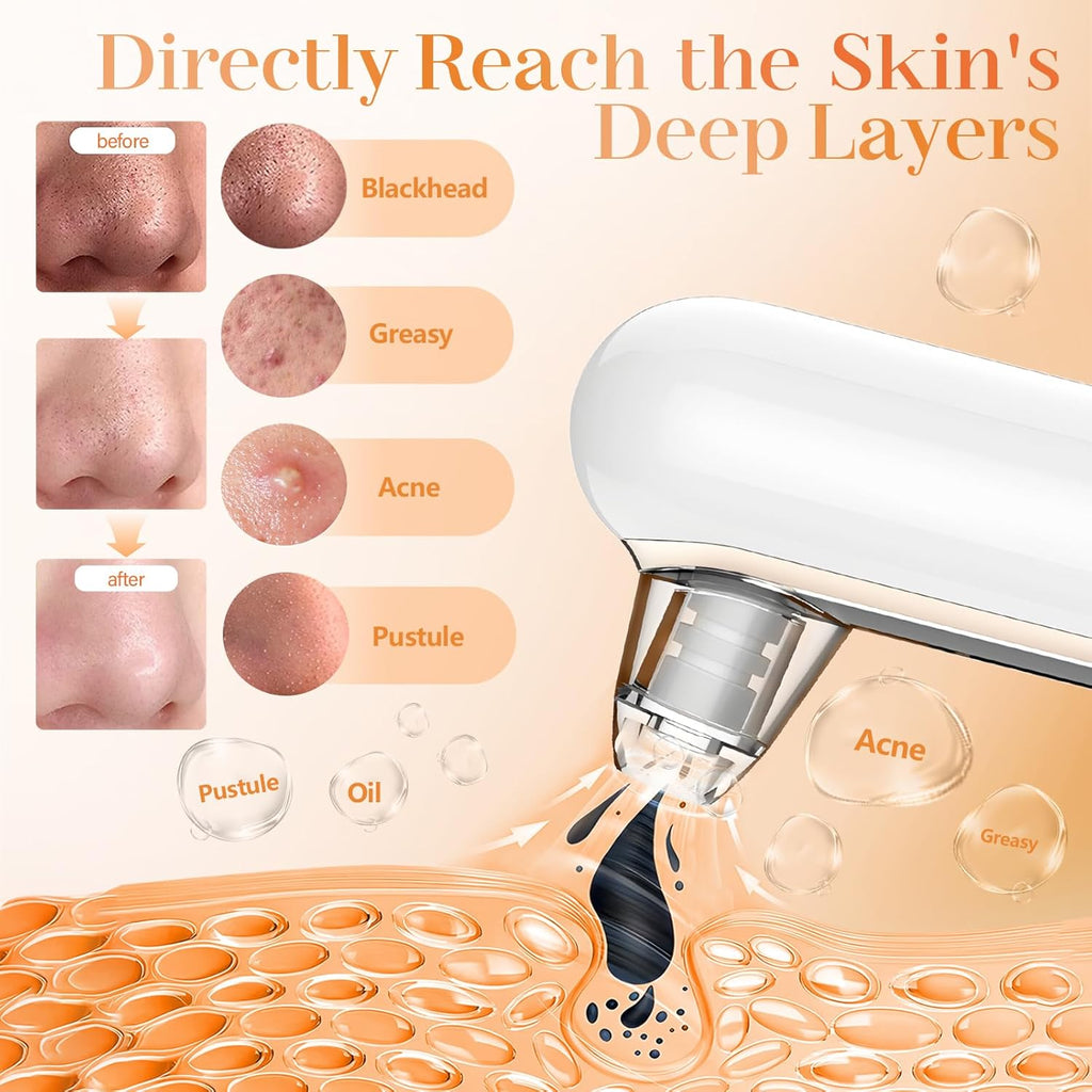 Yccu Blackhead Remover Vacuum Blackhead Vacuum Remover Pore Extractor Blackhead Remover Tool Black Head Remover for Face Blackhead Extractor Pore Cleaner Vacuum with USB Charge 4 Modes 5 Suction Heads