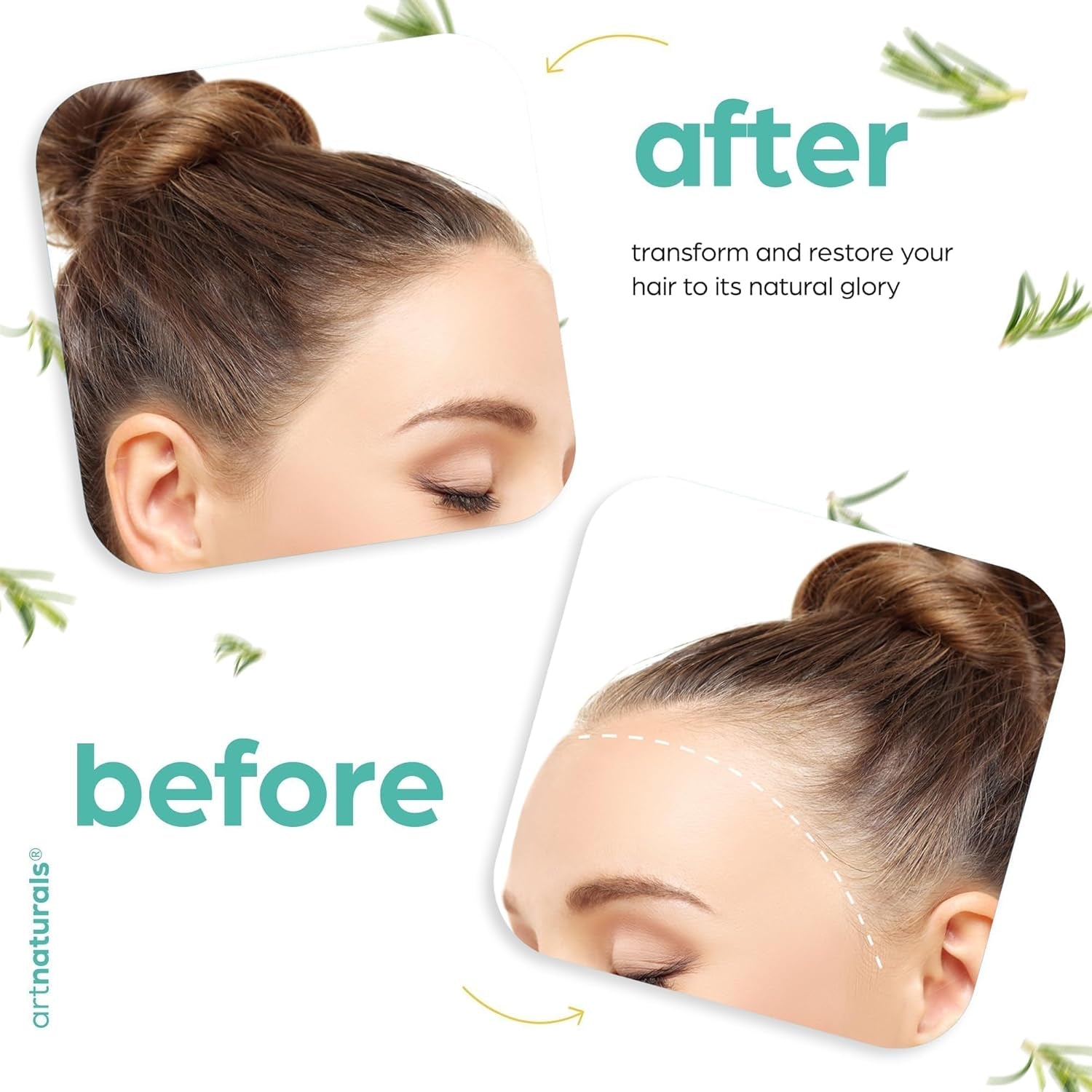 Artnaturals Organic Rosemary Castor Hair Oil + Massager Hair Growth Set Hair Growth Oil 4 Ounces with Coconut & Olive Oil for Dry, Damaged & Split End