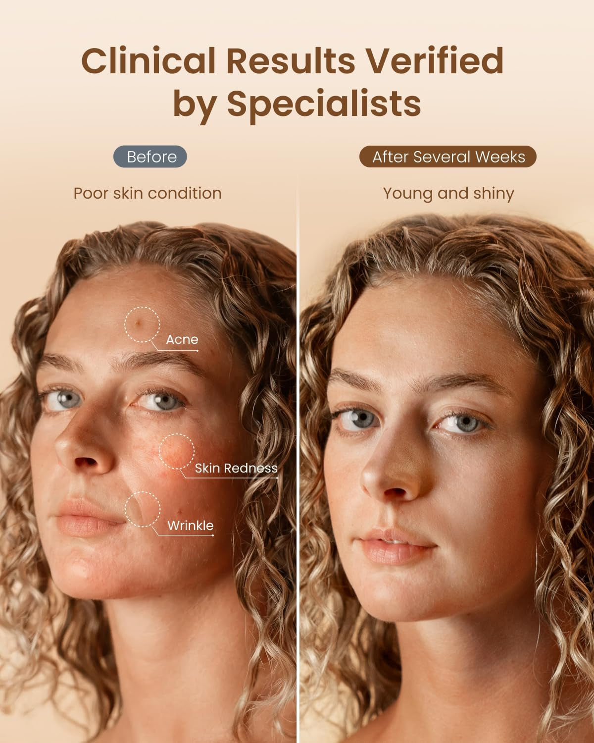 RENPHO 4D Red Light Therapy Mask for Face 2026, Birthday Gifts for Women Mom Wife, 324 Leds Full Face Coverage & 3 Light Modes, Cordless LED Red Light Therapy Face Mask for Home Use & Travel