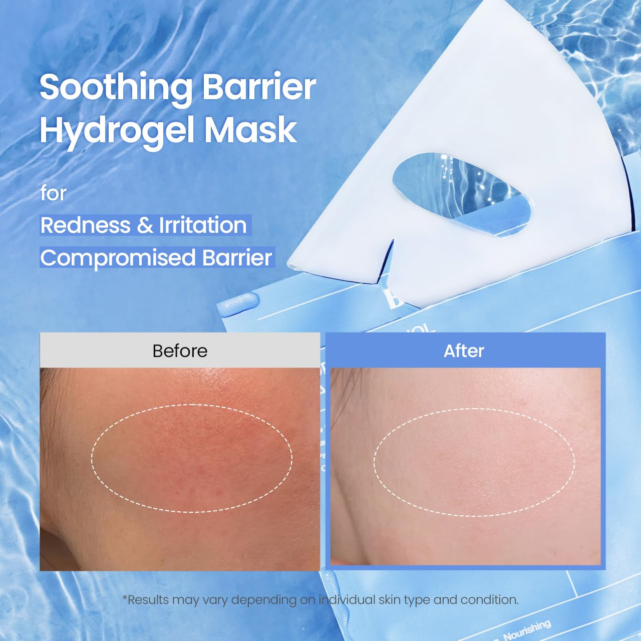 BIODANCE Hydro Cera-Nol Real Deep Mask, Hydrating Overnight Hydrogel Face Mask, Moisturizing, Redness Reducing, Quick Soothing, Korean Skin Care |1.19Oz(34G) X4Ea