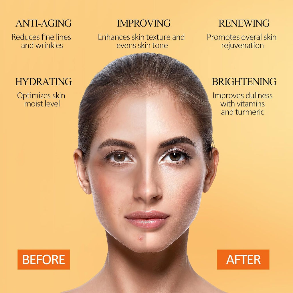 SHVYOG Turmeric Vitamin C Clay Mask with Kaolin Clay for Dull & Blemish-Prone Skin, Deep Cleansing Facial Mask, Face Masks Skincare for Controlling Oil and Refining Pores 5.29 Oz 150G